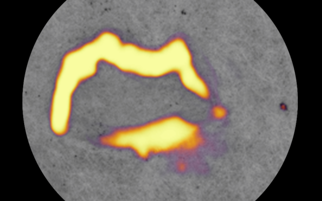 Retina A.I. Vision for Industrial Quality Inspection