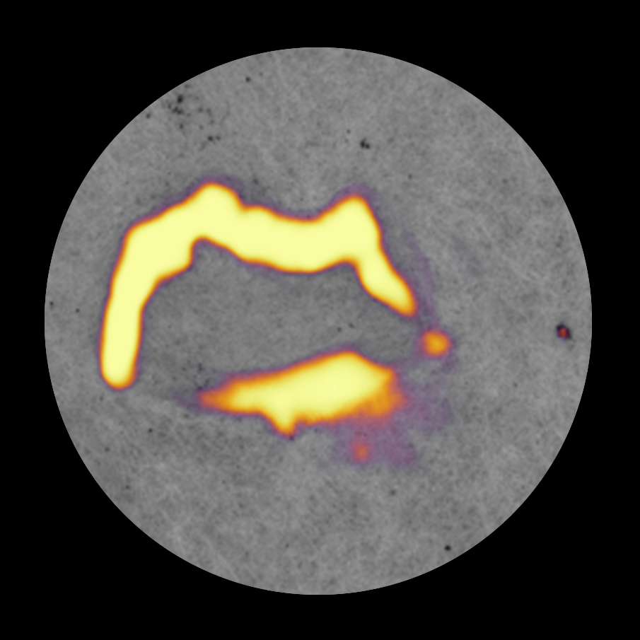 Industrial surface defect detected and localized by Retina A.I. Vision